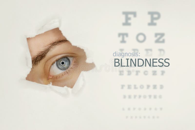 Blindness Disease Poster with Eye Test Chart and Blue Eye on Left Stock