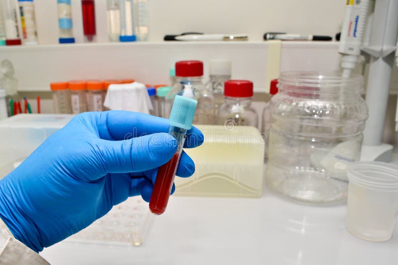 Bloedonderzoek in het laboratorium royalty-vrije stock afbeeldingen Bloedonderzoek in het laboratorium royalty-vrije stock afbeeldingen