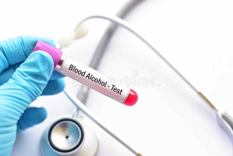 Blood alcohol test stock photo. Image of cirrhosis, chemicals 103404366