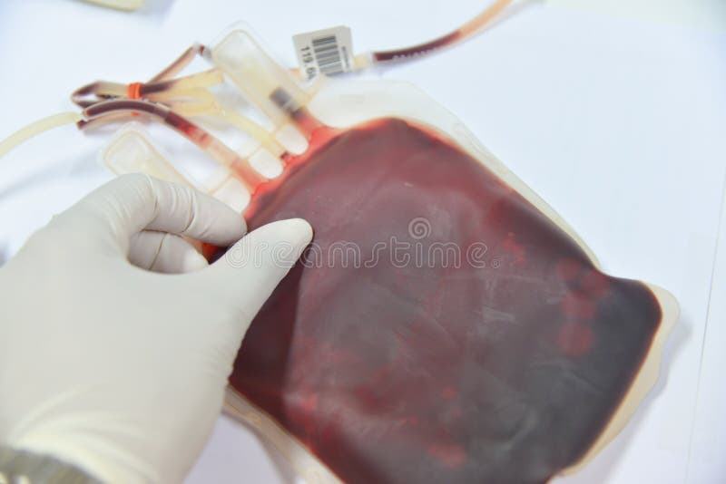 Blood bag in laboratory stock image. Image of surgery 92346919
