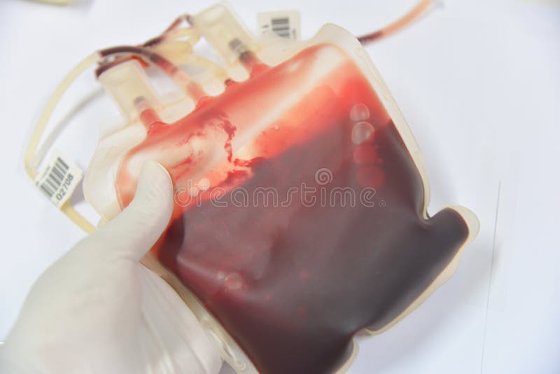 Blood bag in laboratory stock photo. Image of hospital 92347024