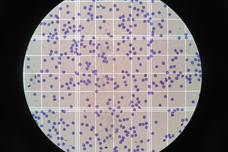 Counting Chamber Stock Photos Free & RoyaltyFree Stock Photos from