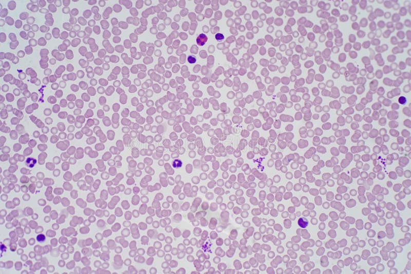 Blood Tissue Under Microscope