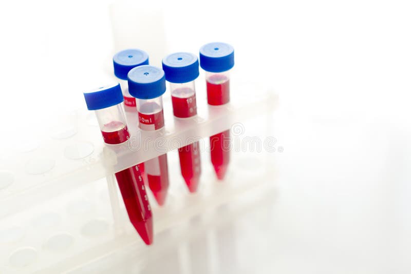 Blood for uric acid test stock photo. Image of acid 106681808