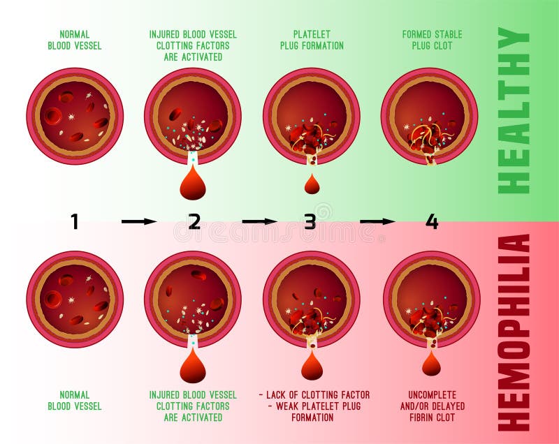 photo Blood Clotting Platelet Cartoon blood clotting stock illustrations