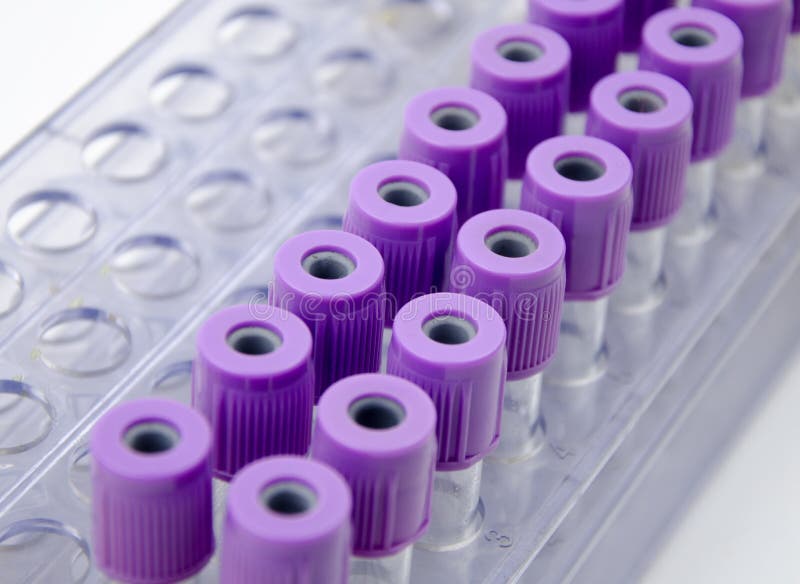 Collection Tube with Test Label on Medical Chart with Personal P Stock