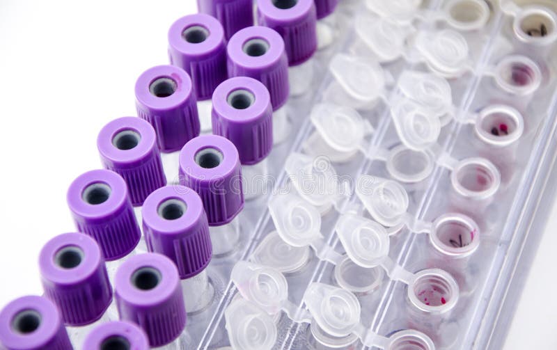 Blood collection tube stock image. Image of cholesterol 46037955