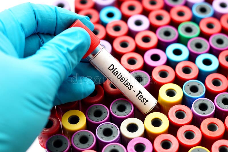 Blood for diabetes test stock photo. Image of chemistry 107239874