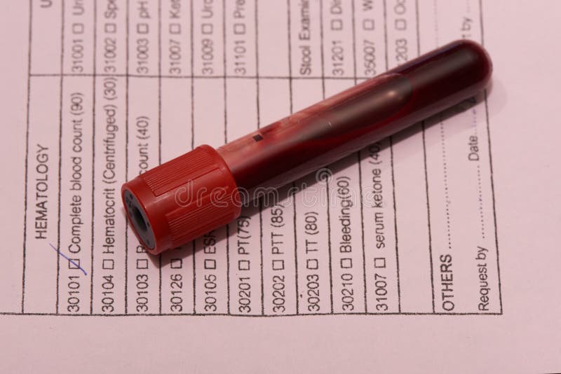 Blood Drawn in Test Tube for Hematology Examination Stock Photo Image of hospital, object