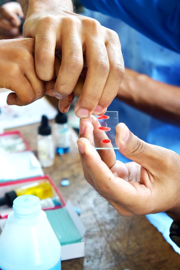 Blood Group Tasting, Blood Grouping, Blood Group and Rh Factor Testing by Agglutination Method