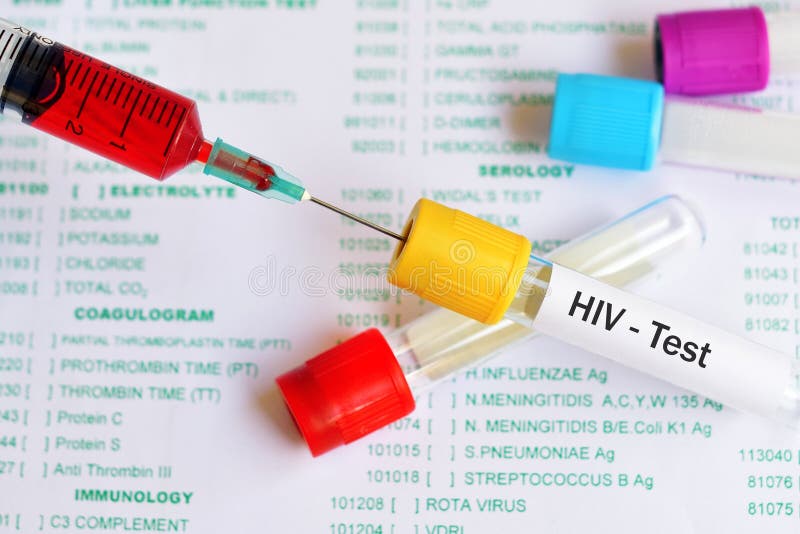 Blood for HIV test stock image. Image of immunology 106681729