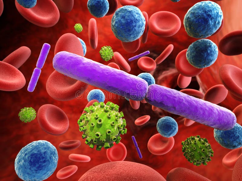 Blood infection with bacteria and virus cells