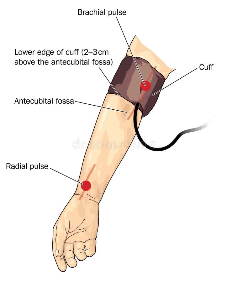 Blood pressure cuff on arm.