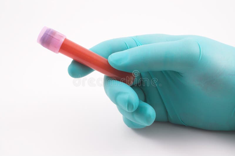 Blood Sample stock photo. Image of analysis, white, testtube 1601784