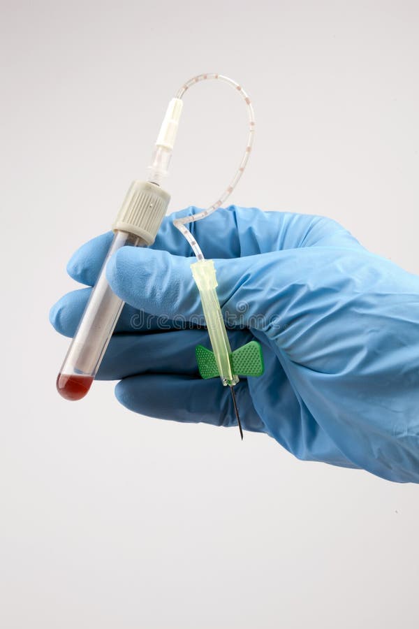 Blood sample stock image. Image of laboratory, medical 23449015