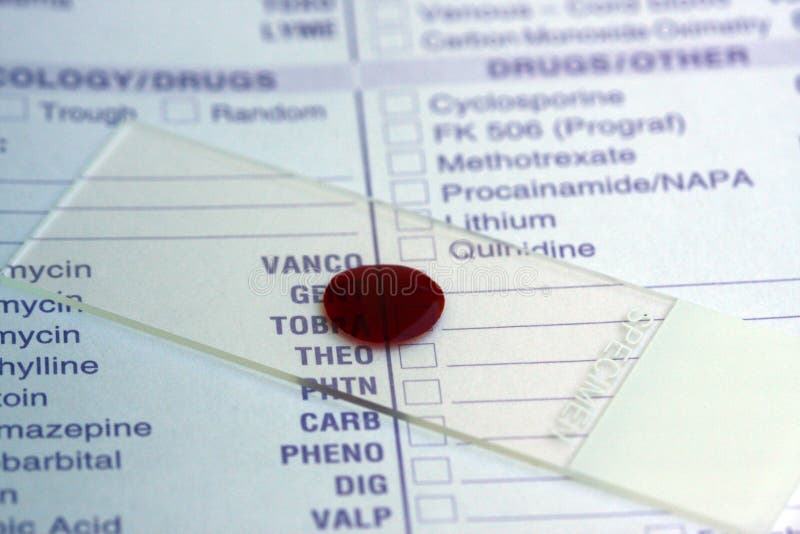 Blood sample stock photo. Image of hospital, form, medecine 3190198