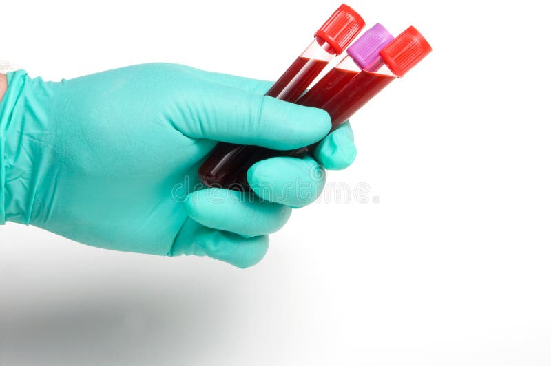 Blood Sample stock photo. Image of blood, finger, medicine 5390034