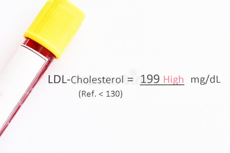 Abnormal High LDLcholesterol Test Result Stock Image Image of