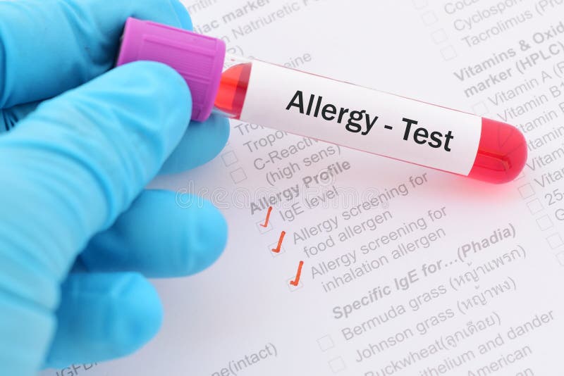 Allergy testing stock image. Image of blood, care, checkup 69307171