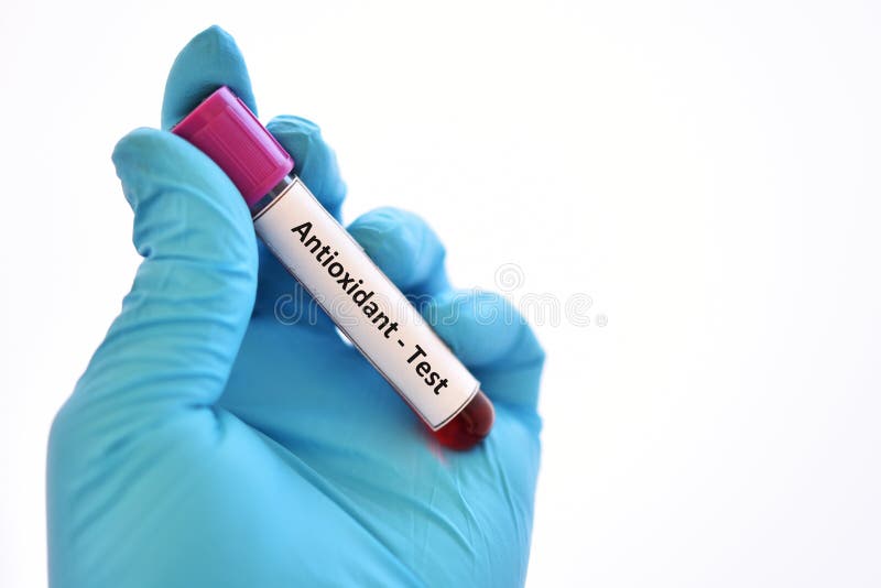 Blood Sample Tube For Procalcitonin Test Stock Photo Image of marker