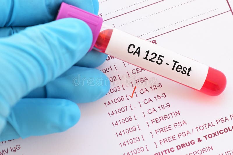 Tumor marker testing stock photo. Image of marker, cancer 33265248