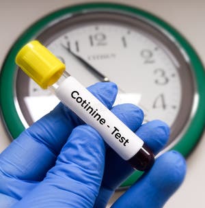 Blood Sample For Cotinine Or Nicotine Test Stock Image Image Of Hospital Biology 302485953 Blood Sample For Cotinine Or Nicotine Test Stock Image Image Of Hospital Biology 302485953