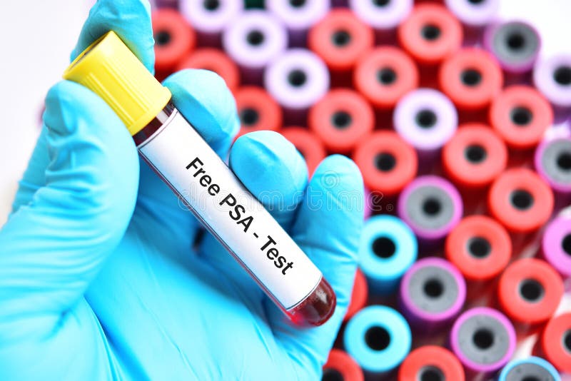 Blood Sample for Free PSA Test Stock Photo Image of checkup, serology
