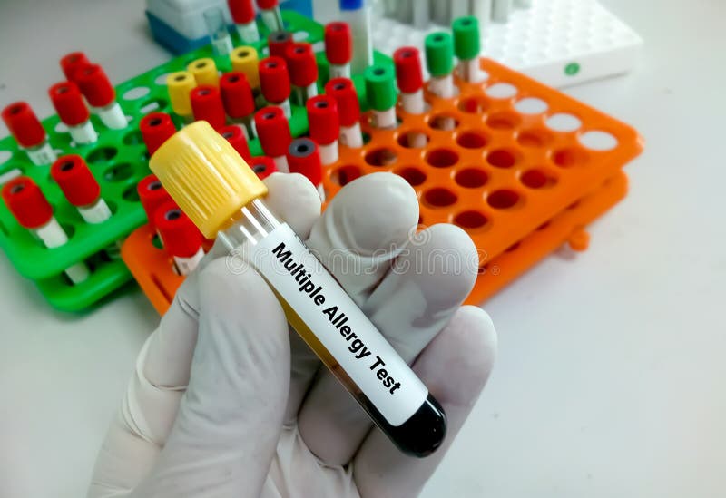 Blood Sample For Multiple Allergy Test Stock Photo Image Of Care how-do-they-test-dogs-for-human-allergies