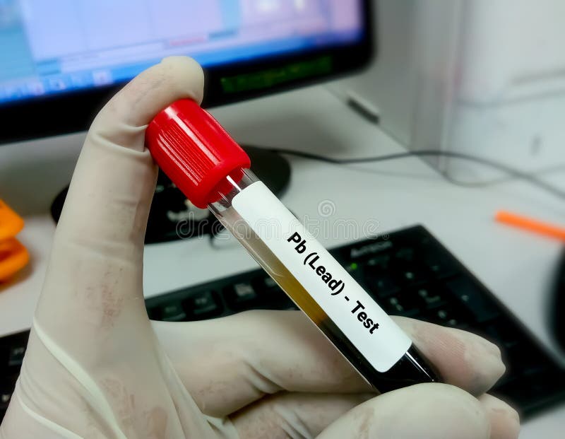 Blood Sample for Pb (Lead) Test Stock Photo Image of doctor