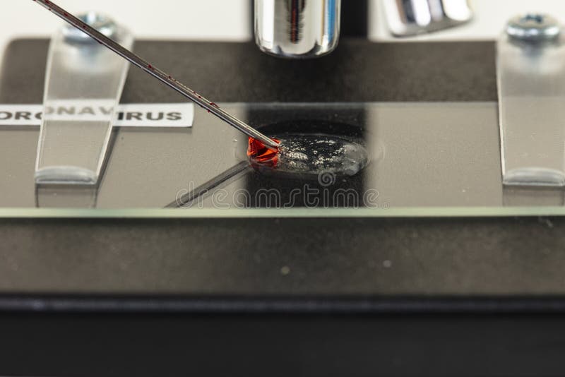 6,064 Blood Sample Microscope Stock Photos Free & RoyaltyFree Stock