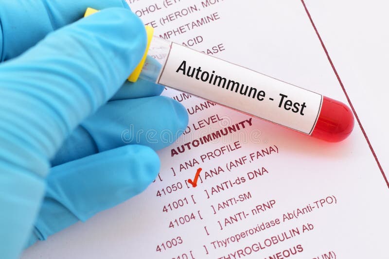 Autoimmune test stock image. Image of experiment, antibody 68974425