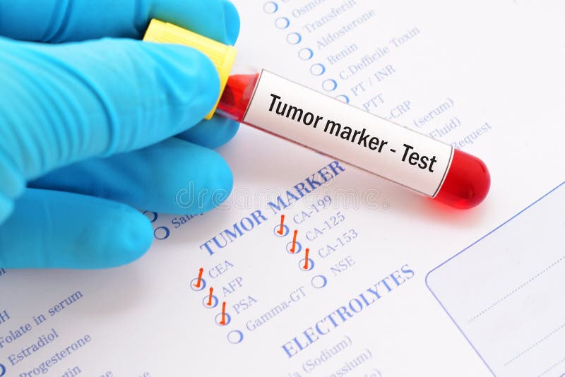 Tumor marker testing stock photo. Image of marker, cancer 33265248