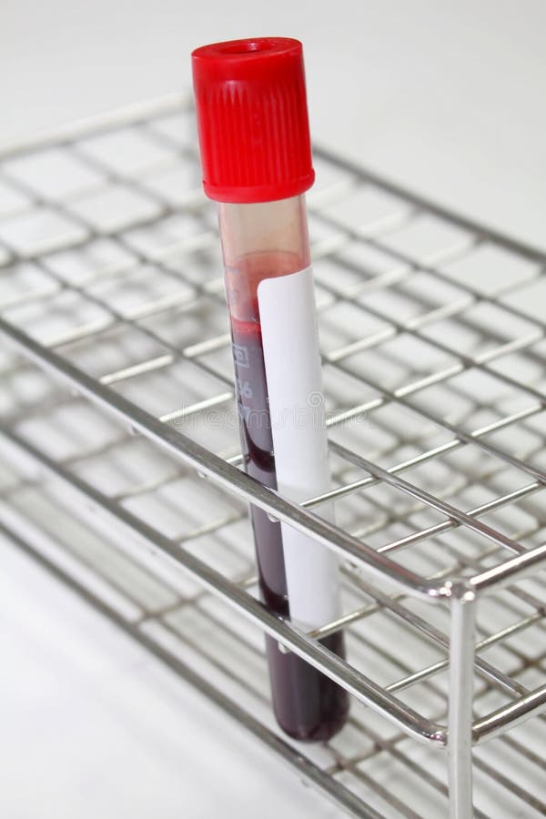 Blood Sample in a Test Tube Vacutainer Stock Photo Image of