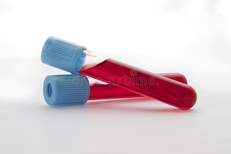 Blood sample in test tubes stock photo. Image of analysis 36604448