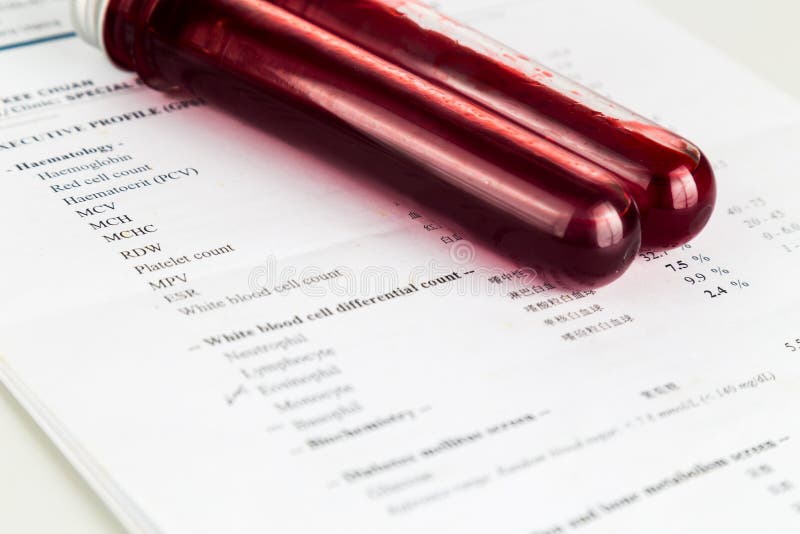 Blood Sample in Test Tubes with Health Analysis Screening Report Stock