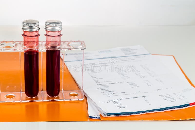 Blood Sample in Test Tubes with Health Analysis Screening Report Stock