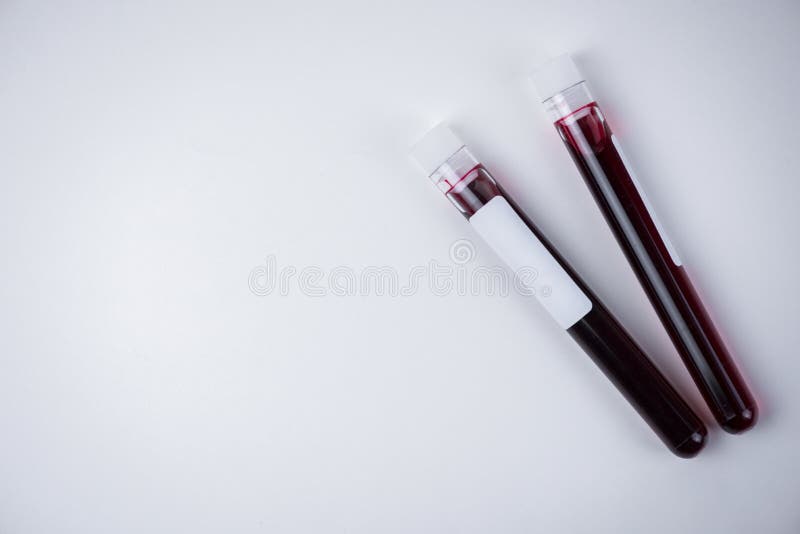 Blood Sample Test Tubes on White Background , Blood Sample for COVID19