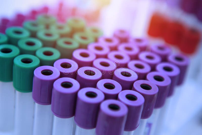 Blood Sample for Testing.Medical Equipment Stock Photo Image of clinic, gray 161173294