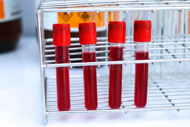 Blood Sample To Analyze in the Laboratory Stock Image Image of