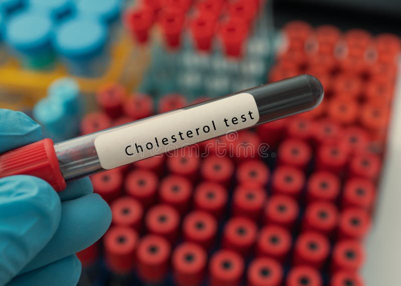 Blood Sample Tube with Abnormal High Cholesterol Test Stock Image
