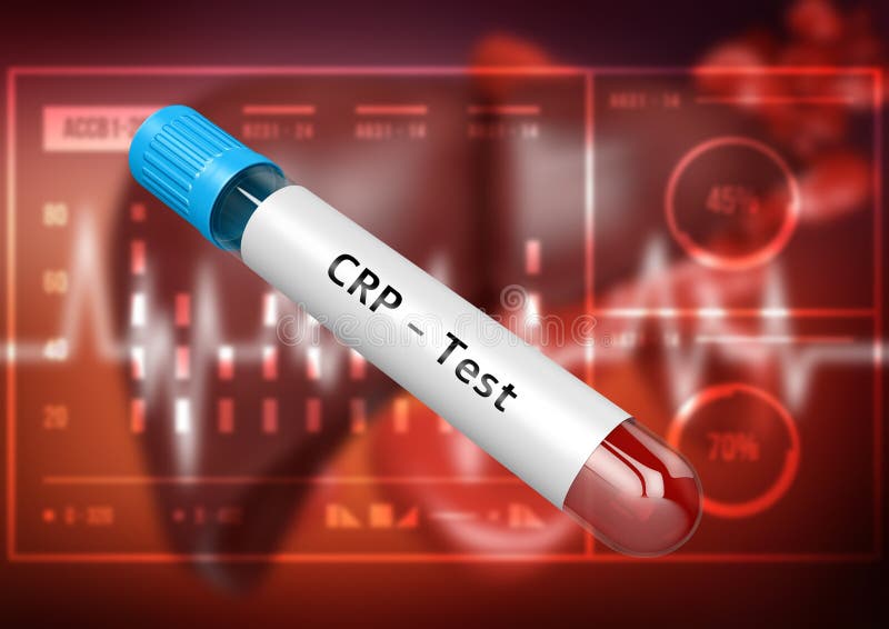 Creactive Protein (CRP, Human) Inflammation Biomarker, Chemical
