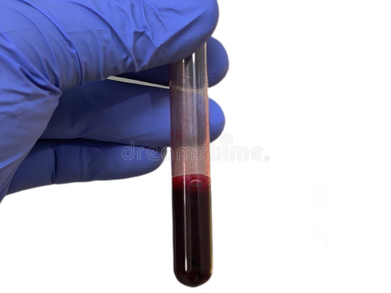 Blood Sample Tube for Medical Laboratory Test. Stock Photo Image of