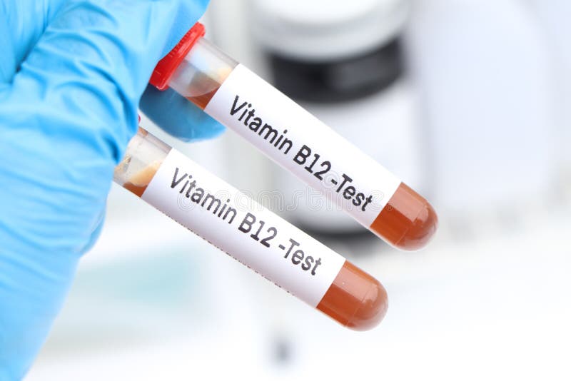 Blood Samples for Testing Vitamin B12 in the Laboratory Stock Photo Blood Samples for Testing Vitamin B12 in the Laboratory Stock Photo