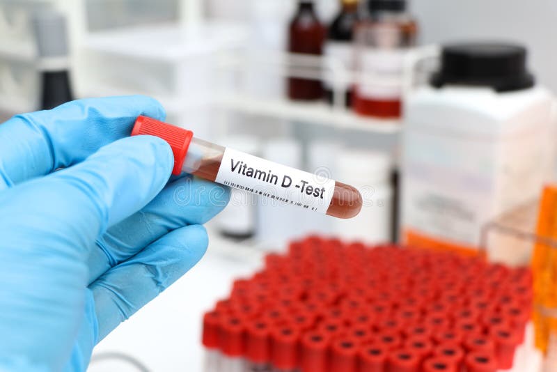 Blood Samples for Testing Vitamin D in the Laboratory Stock Photo