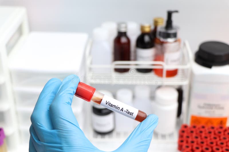 Blood Samples for Testing Vitamin a in the Laboratory Stock Photo