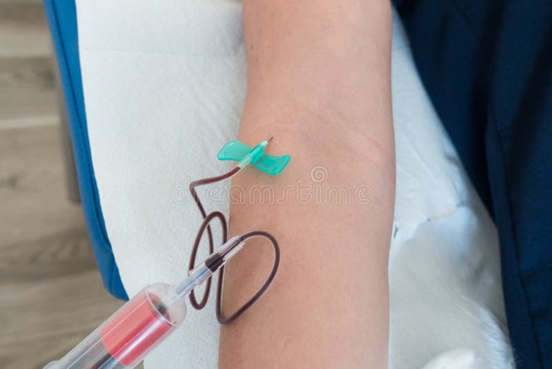 Blood Sampling Performed with Butterfly Needle and Vacutainer System