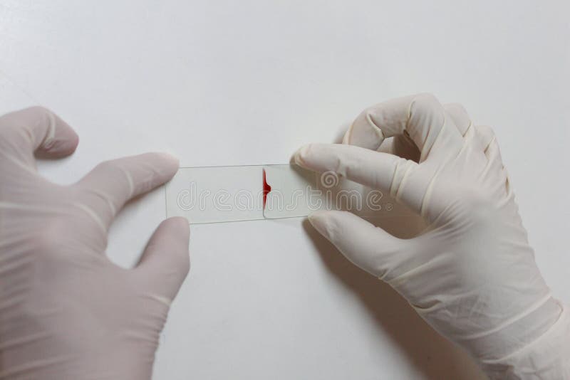 Blood smear royalty free stock images Blood smear royalty free stock images