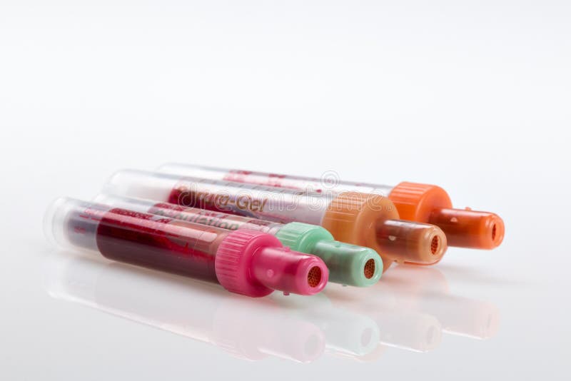 Blood Test, Blood Samples on a Laboratory Form Stock Image Image of