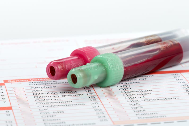 Blood Test, Blood Samples on a Laboratory Form Stock Photo Image of
