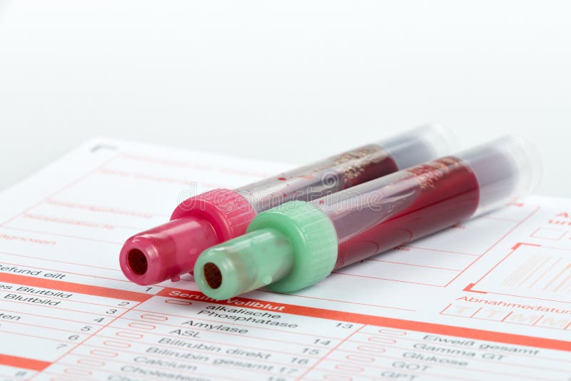 Blood Test, Blood Samples on a Laboratory Form Stock Image Image of